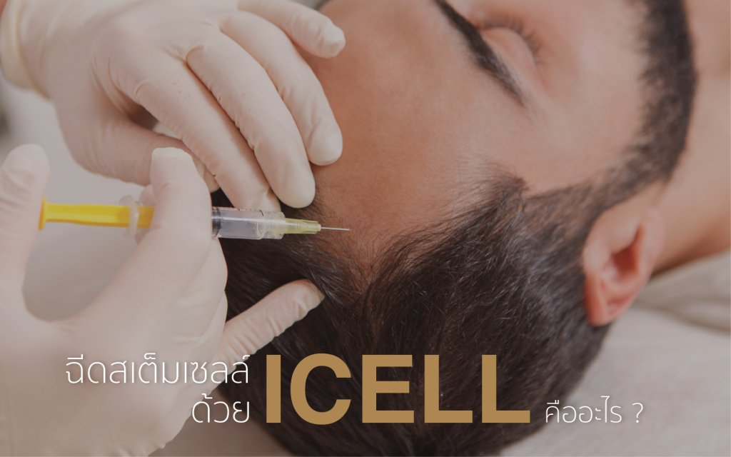 การฉีดสเต็มเซลล์ด้วย ICELL คืออะไร